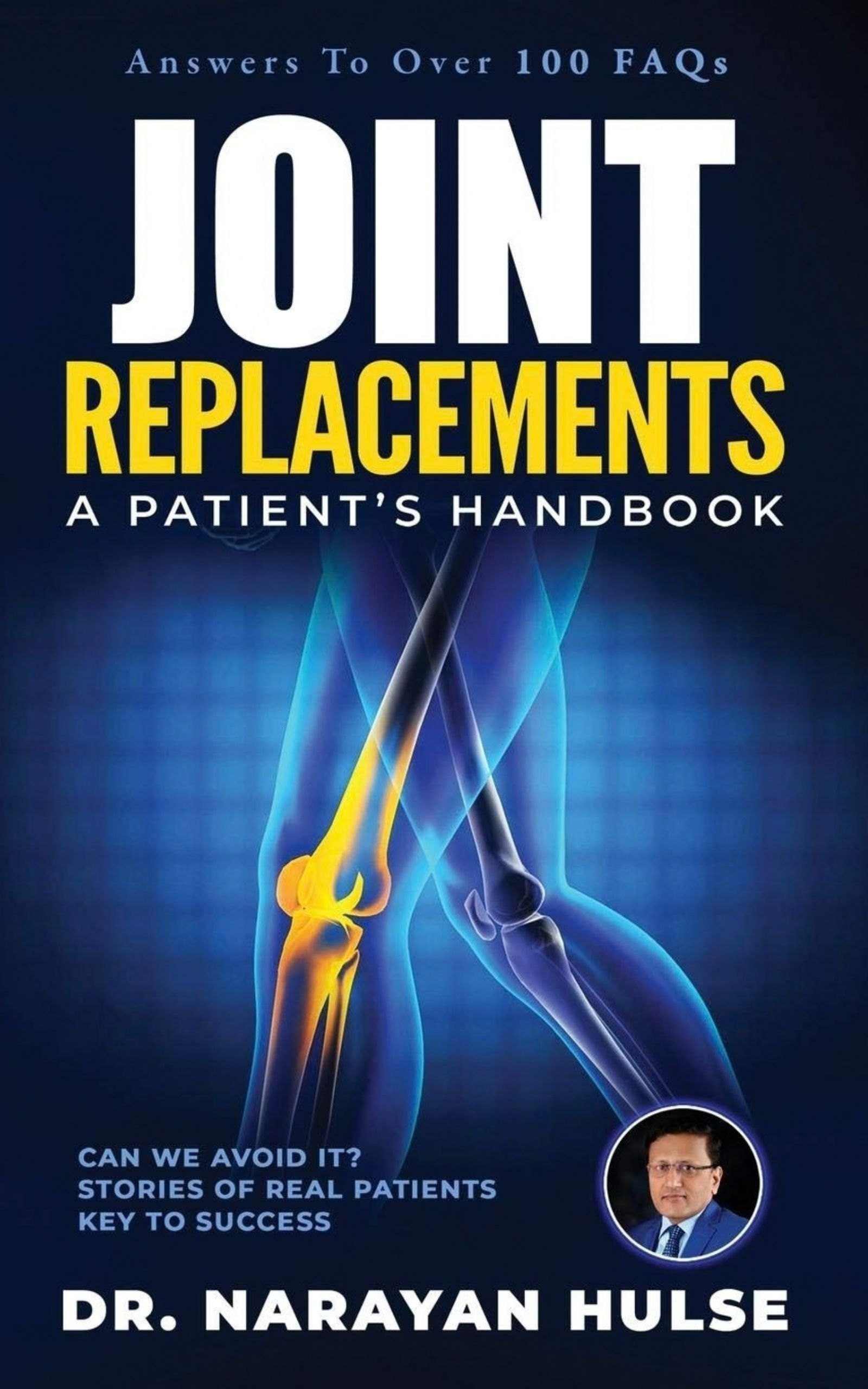 Cover of Joint Replacements